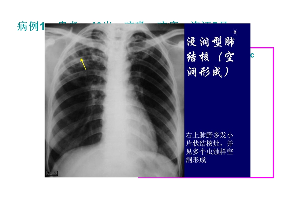 执业医师考试影像阅片第1组课件.ppt_第2页