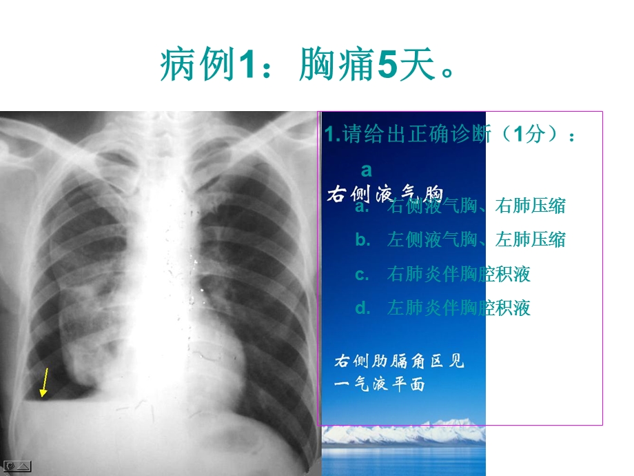 执业医师考试影像阅片第1组课件.ppt_第3页