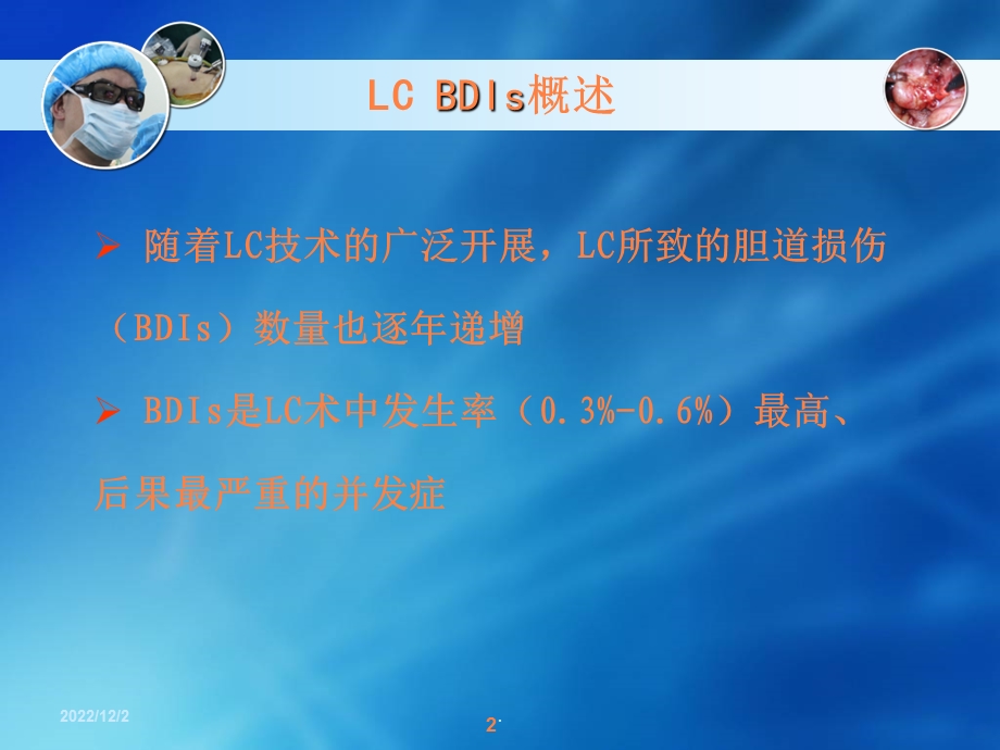 腹腔镜胆囊切除术胆道损伤的发生原因及其预防治疗措课件.ppt_第2页