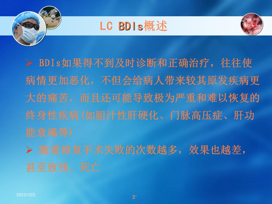 腹腔镜胆囊切除术胆道损伤的发生原因及其预防治疗措课件.ppt_第3页