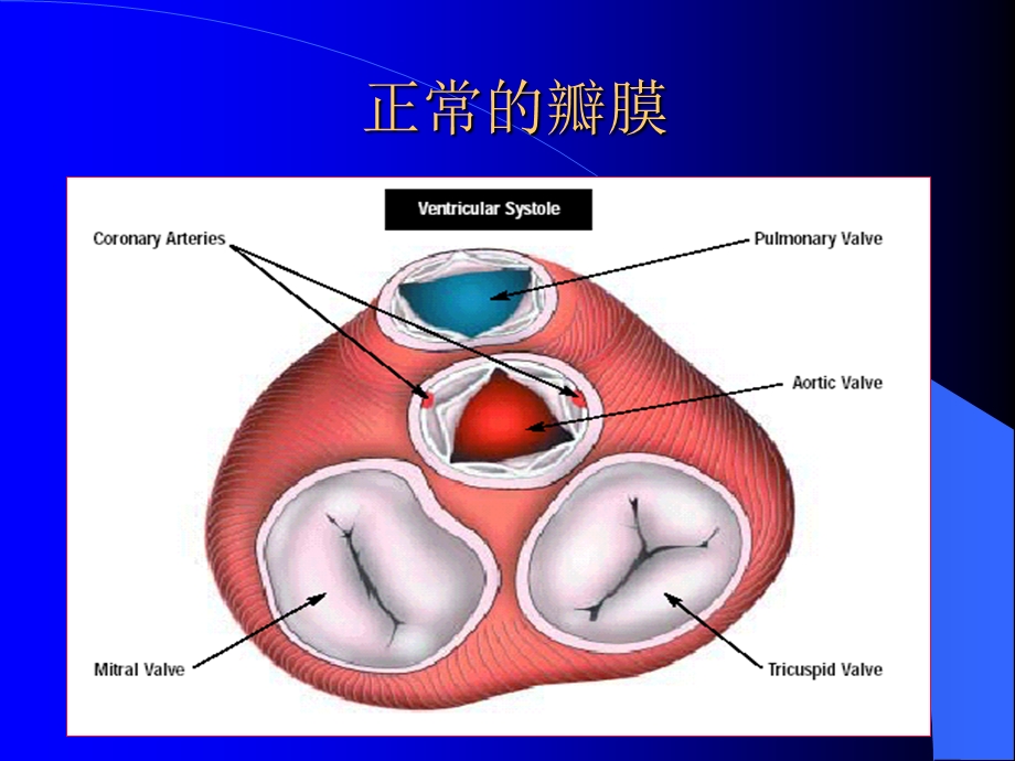 心脏瓣膜病 精品课件.ppt_第2页