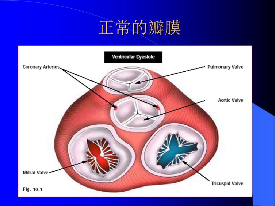 心脏瓣膜病 精品课件.ppt_第3页