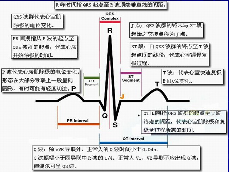 心电图ppt课件.ppt_第3页