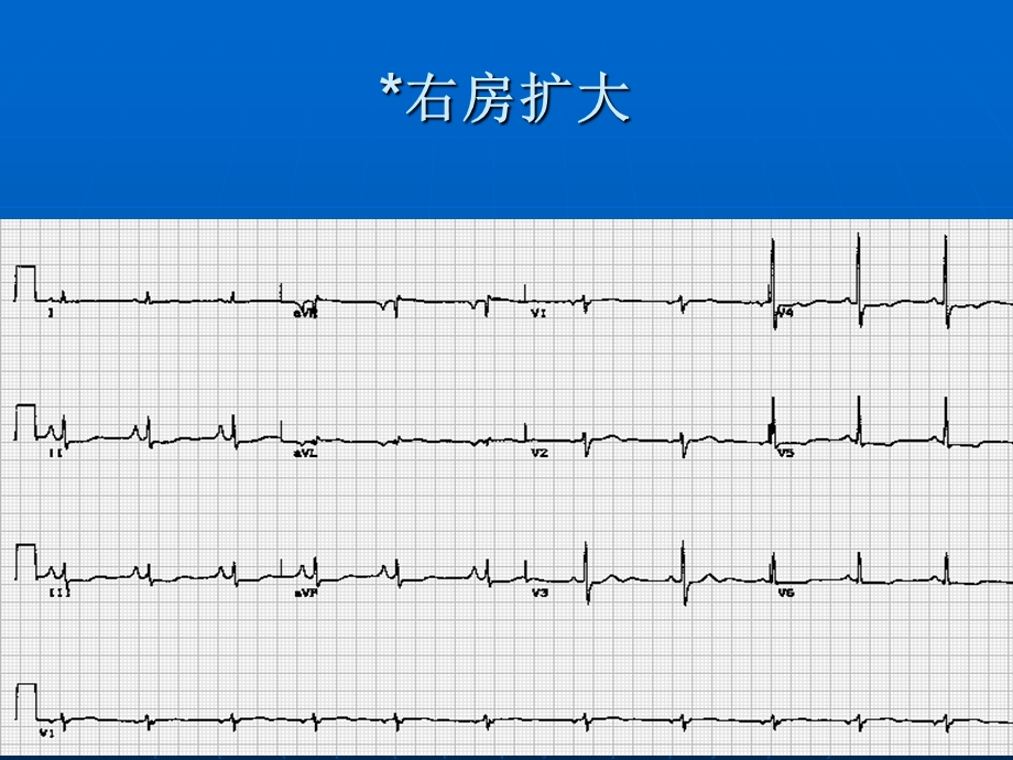 心电图识记课件.ppt_第2页