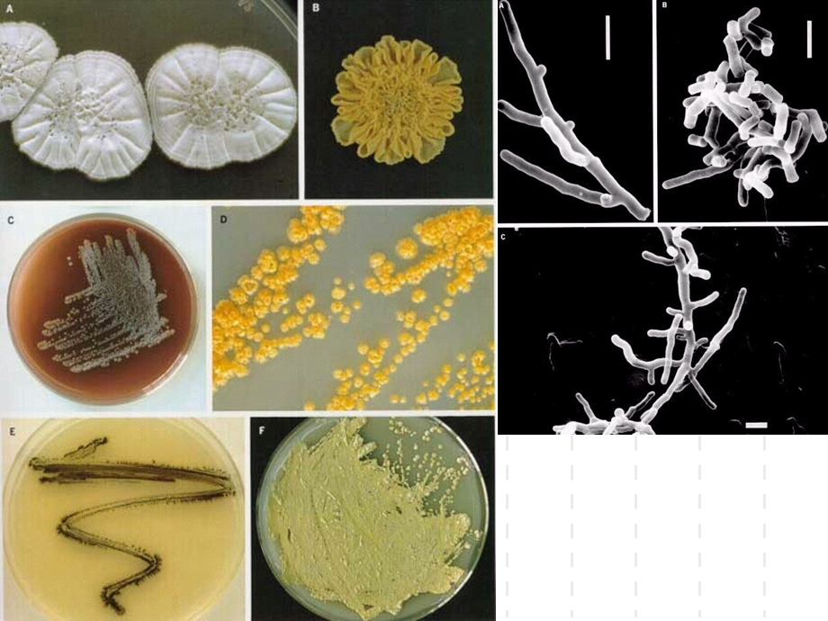 微生物学 放线菌课件.ppt_第3页