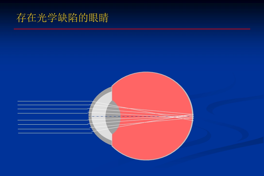 波前像差原理及应用综述课件.ppt_第3页