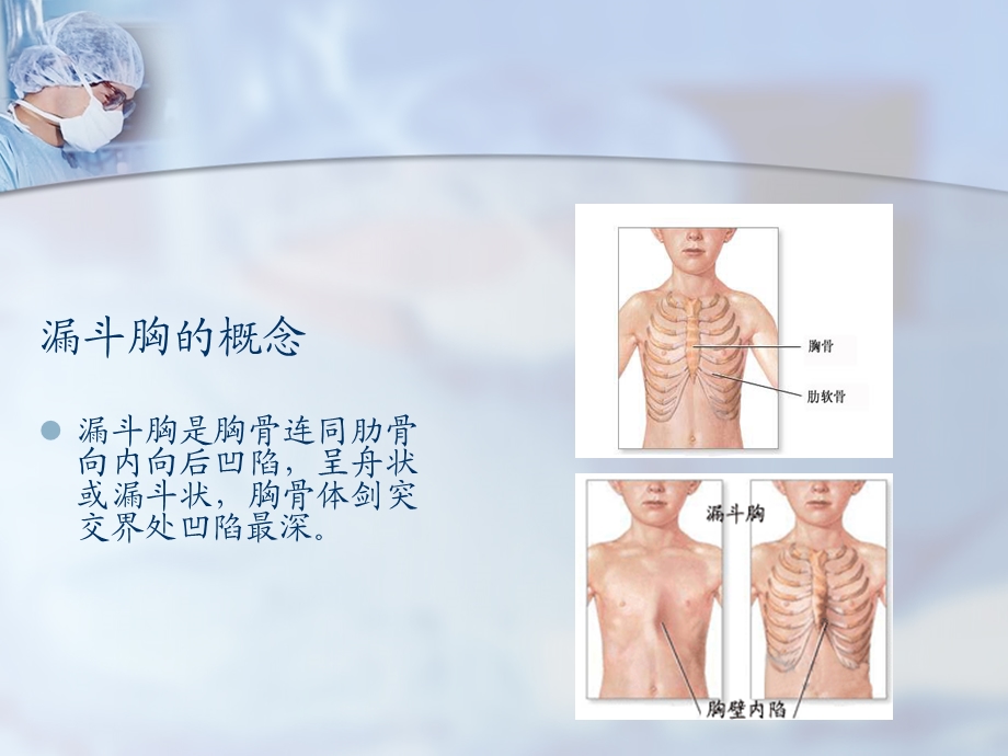 漏斗胸病人围手术期护理课件.ppt_第2页