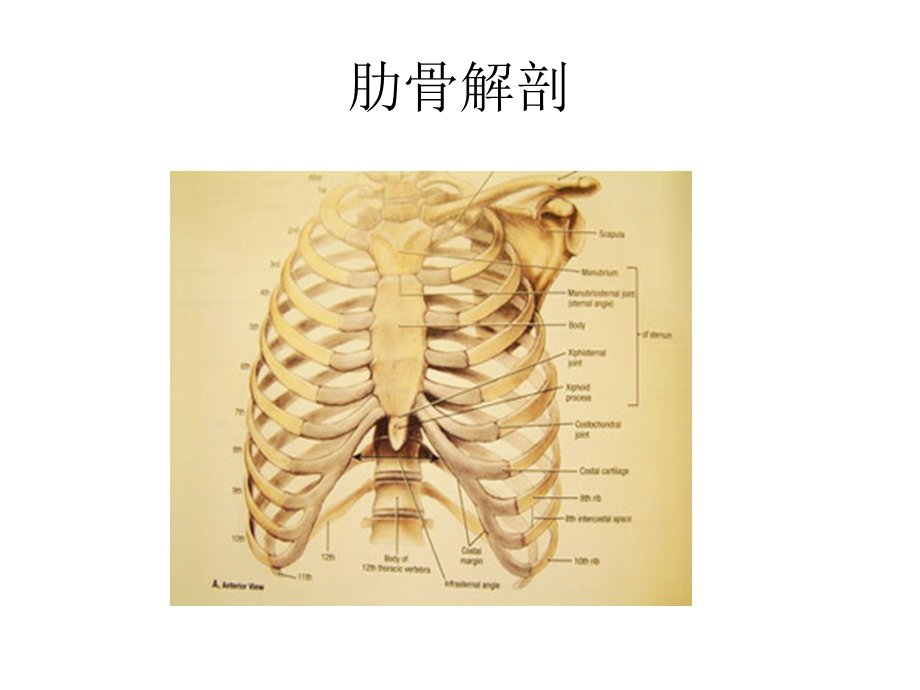 提高肋骨骨折的影像学诊断课件.ppt_第3页