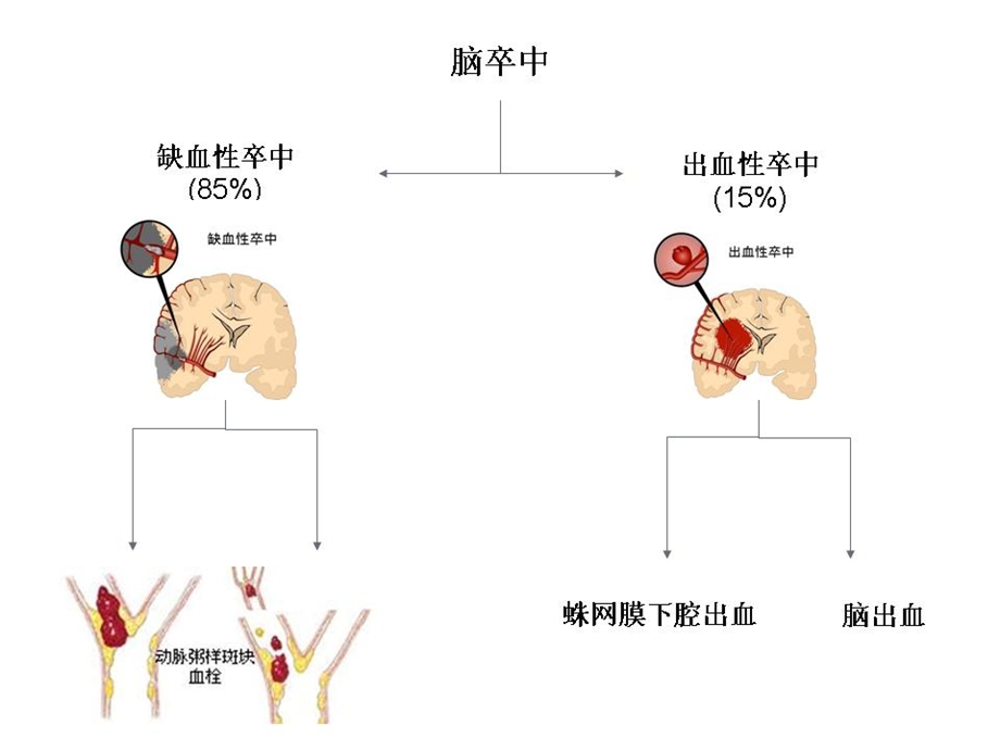 溶栓相关试验及进展课件.pptx_第2页