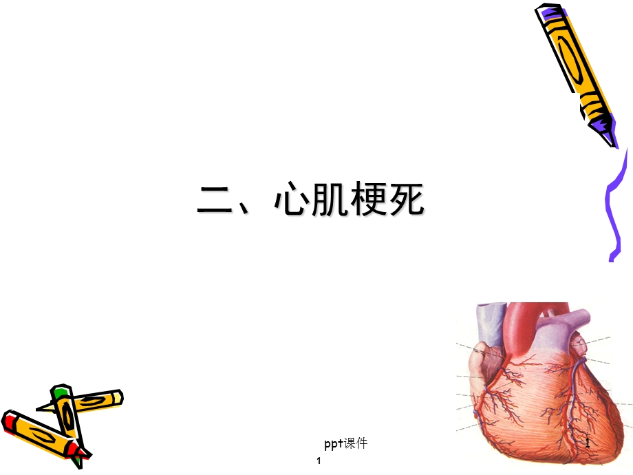 心肌梗死的护理课件.ppt_第1页