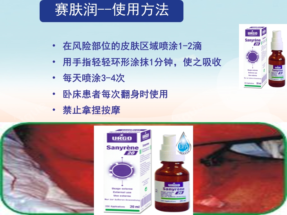 赛肤润常见的临床应用课件.ppt_第2页