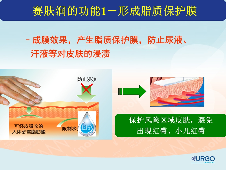 赛肤润常见的临床应用课件.ppt_第3页