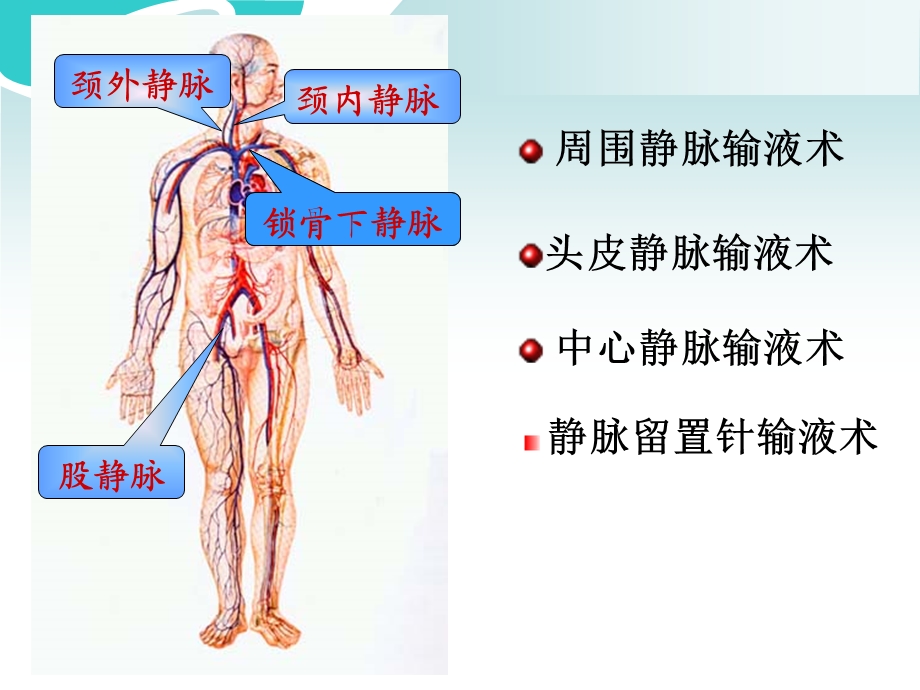 深静脉穿刺课件.ppt_第2页