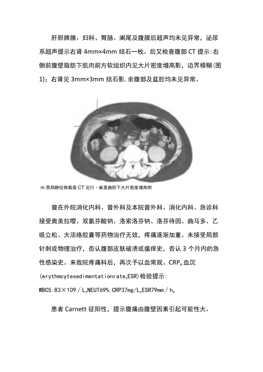 腹壁蜂窝织炎疼痛病例报告.docx_第2页