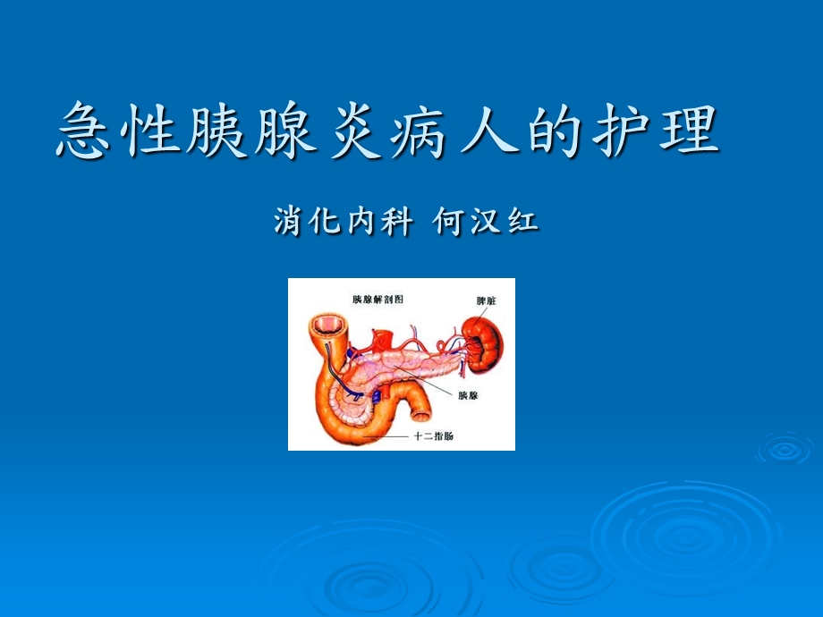 急性胰腺炎PPT示范课件.ppt_第1页