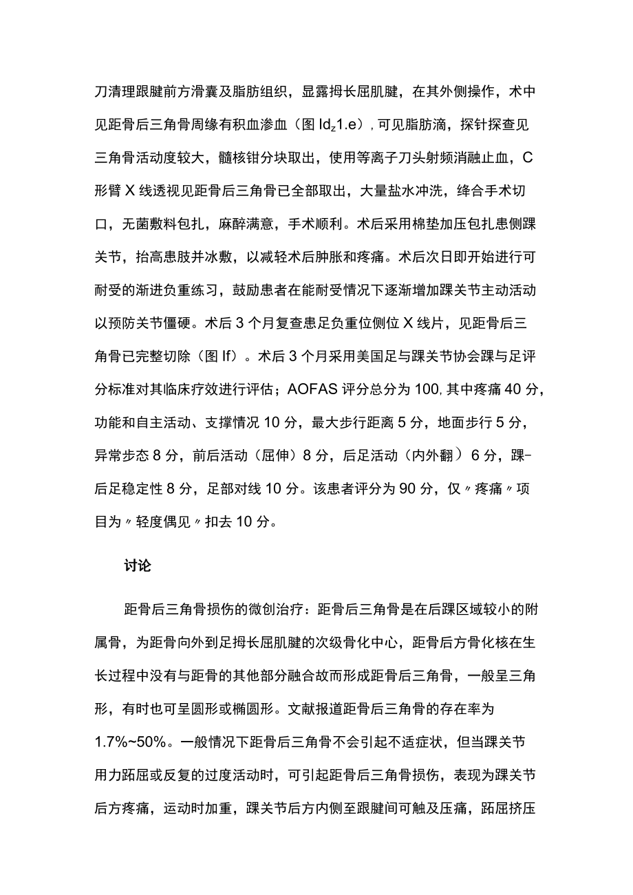 骨科医师晋升副主任（主任）医师病例分析专题报告（距骨后三角骨骨折诊疗）.docx_第3页