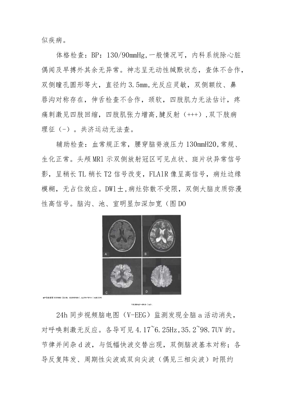 神经内科晋升副主任医师高级职称专题报告病例分析汇编三篇.docx_第3页