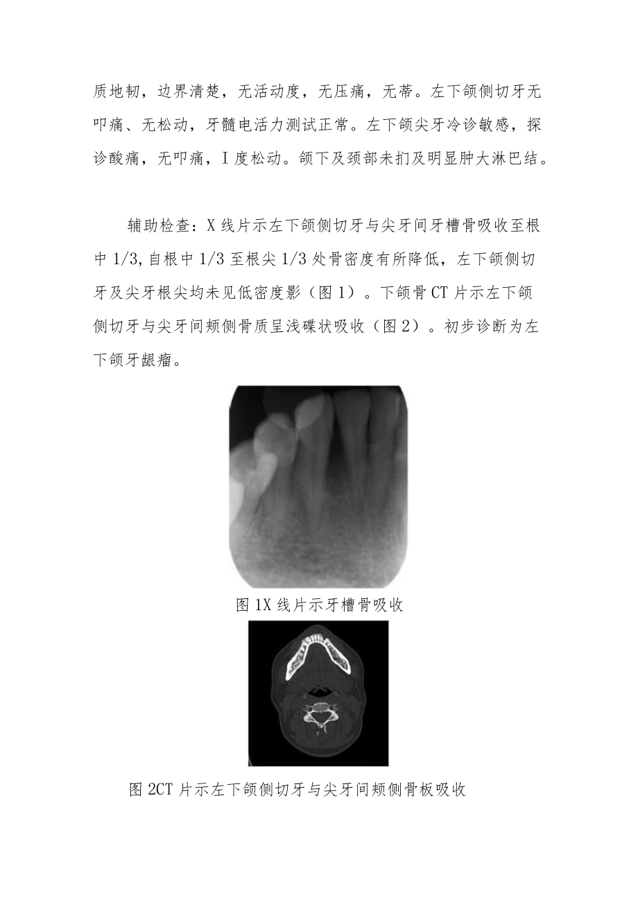 口腔科晋升副主任（主任）医师病例分析专题报告2篇.docx_第3页