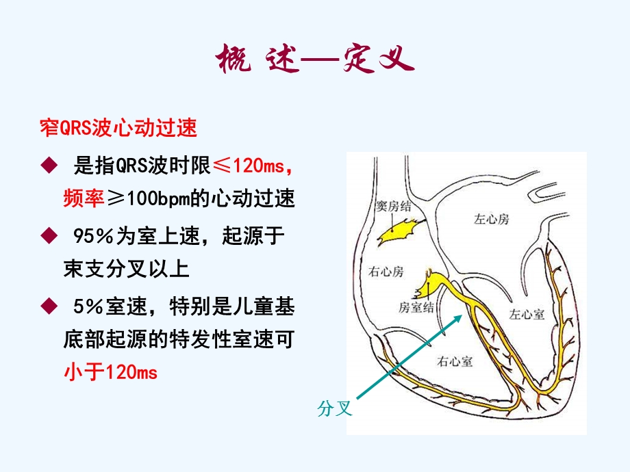 窄QRS波心动过速鉴别诊断课件.ppt_第2页