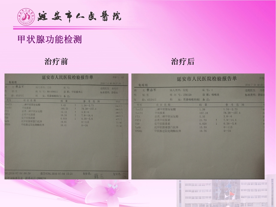 甲状腺术后管理的规范化探讨课件.ppt_第3页