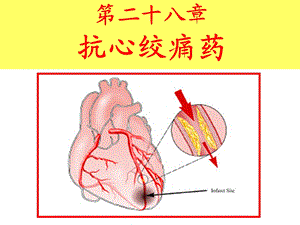 第28章 心绞痛课件.ppt