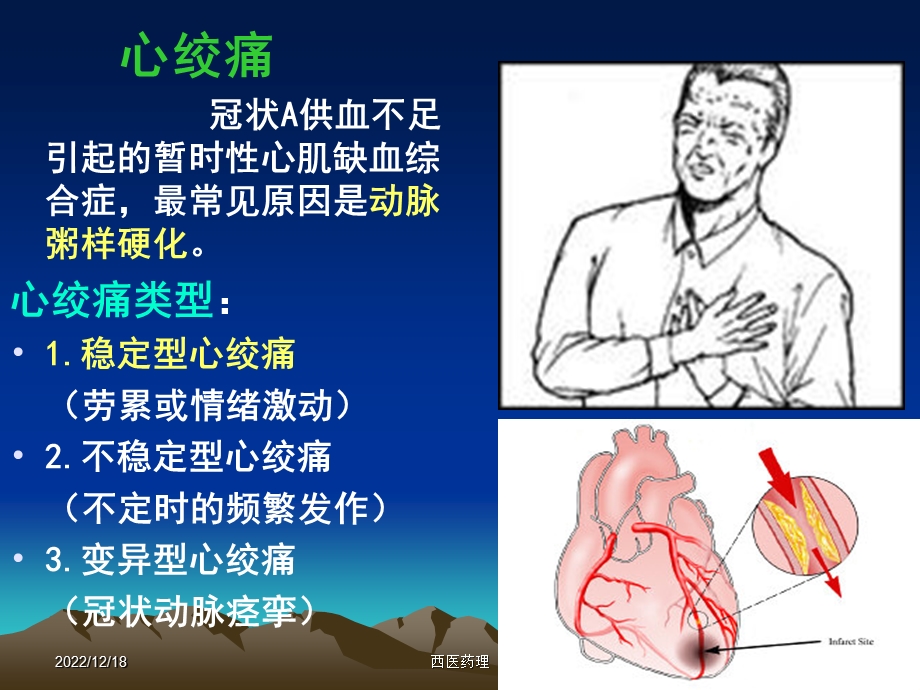 西医药理学第十六节抗心绞痛药课件.ppt_第2页