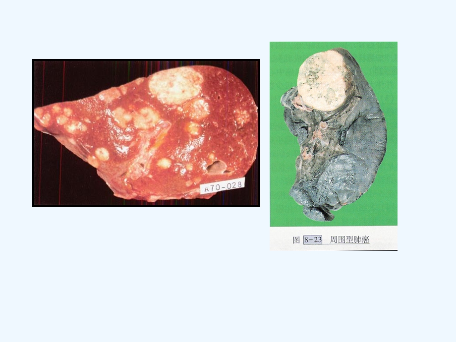 肿瘤动物模型和抗肿瘤药物的研究方法课件.ppt_第3页