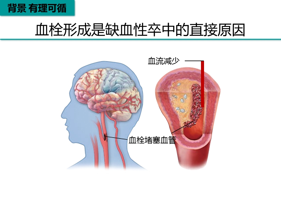 脑梗死再灌注治疗课件.pptx_第3页