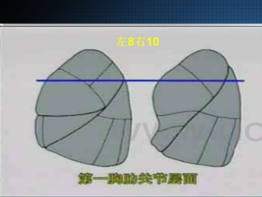 胸部CT读片指南课件.ppt_第2页