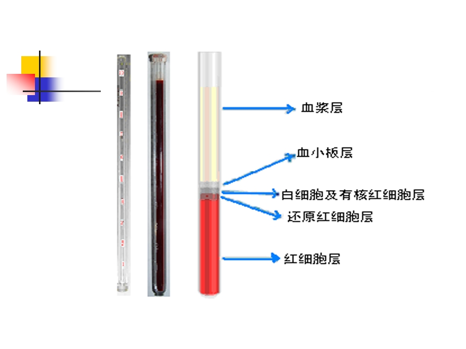 血液一般检验课件.ppt_第2页