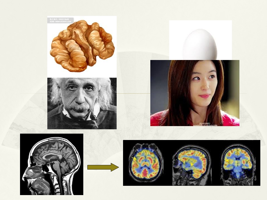 神经系统核医学课件.ppt_第2页