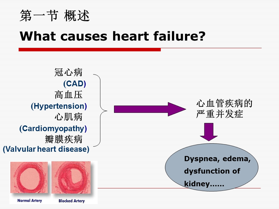 病理生理10心衰课件.ppt_第2页