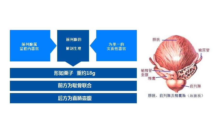 腹腔镜下前列腺癌课件.ppt_第3页