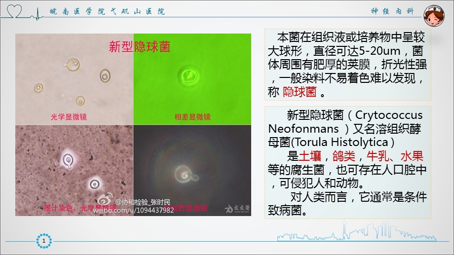 脑膜炎课件.ppt_第2页