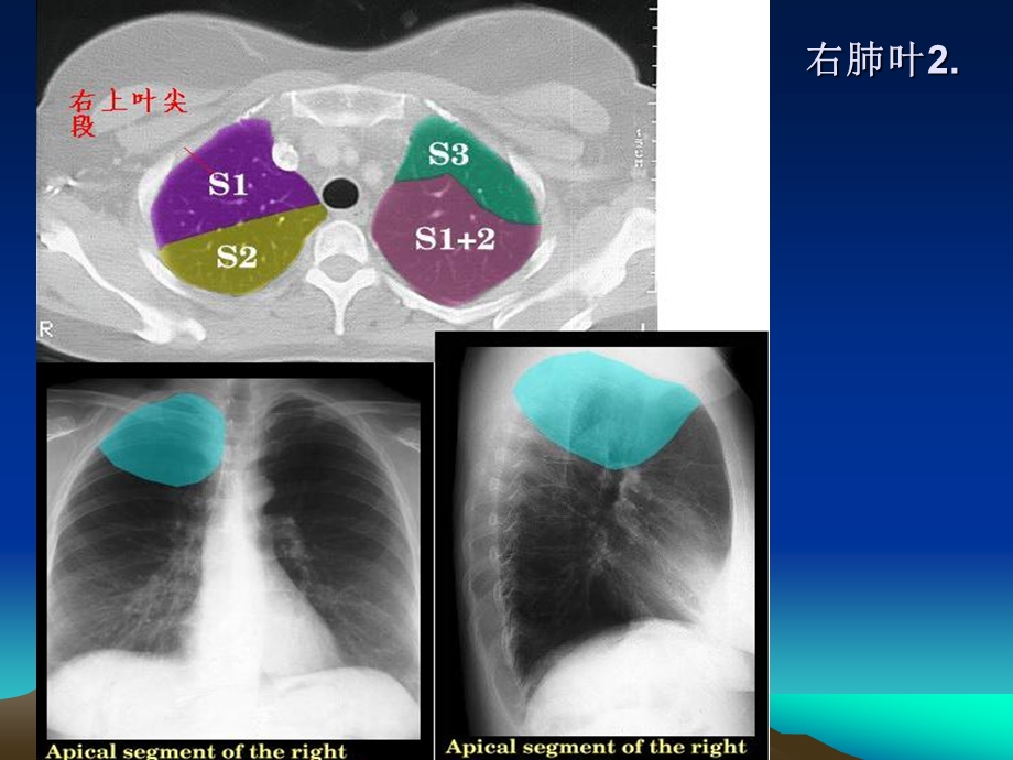 胸部CT及X线正常彩色解剖图谱课件.ppt_第3页