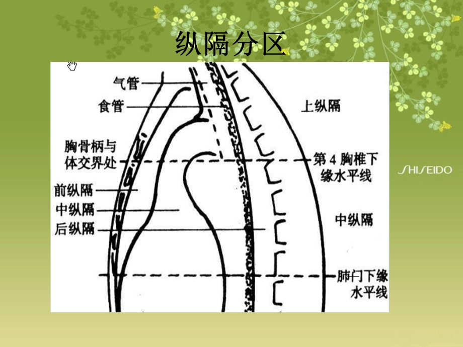 纵隔常见疾病的影像学表现课件.ppt_第3页