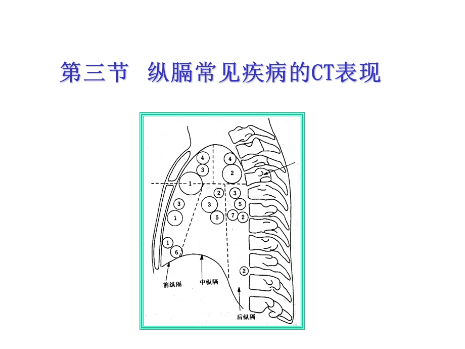 纵隔病变CT改变课件.ppt_第1页