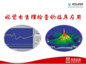 视觉电生理检查的临床应用课件.ppt