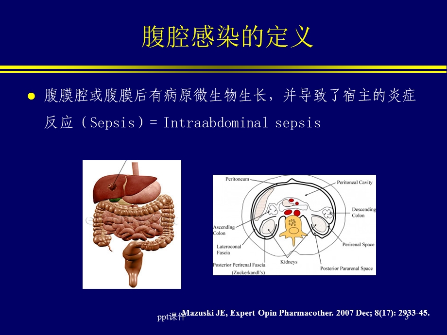 腹腔感染的治疗课件.ppt_第3页