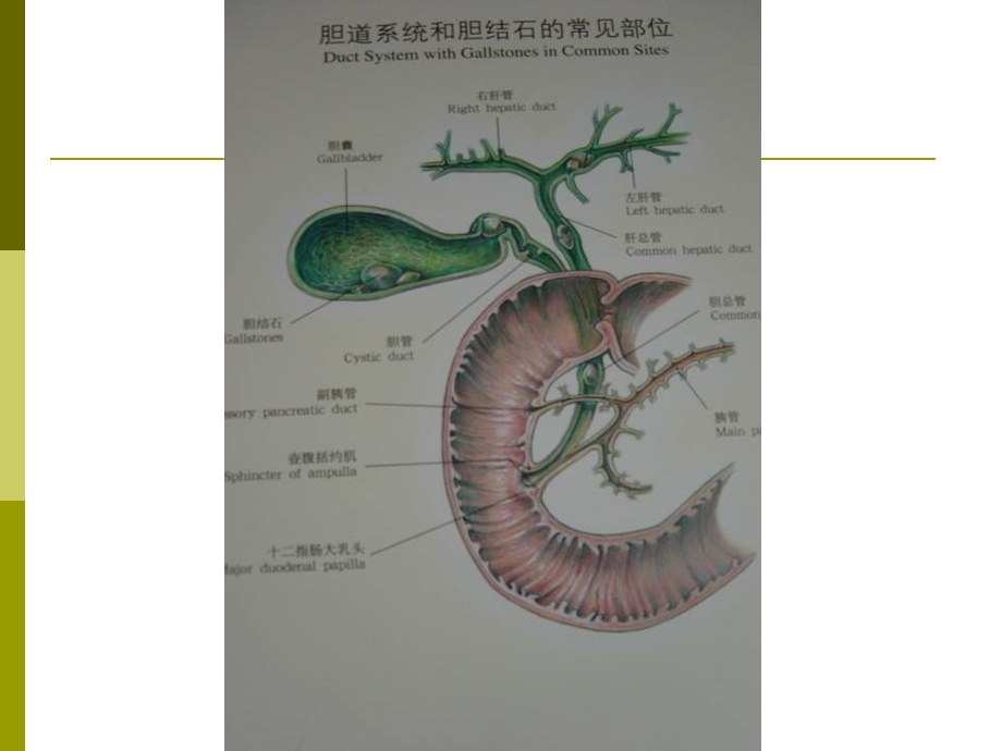 胆囊结石成因和治疗进展课件.ppt_第2页