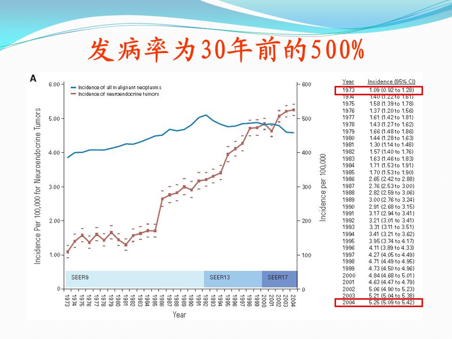 神经内分泌肿瘤课件.ppt_第3页