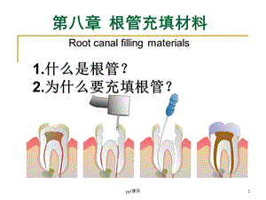 第八章 根管充填材料课件.ppt