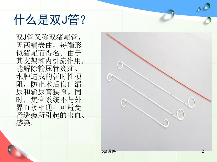 留置双J管的健康指导课件.ppt_第2页