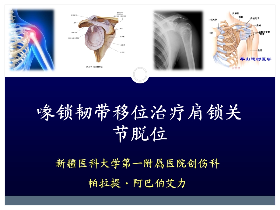 肩关节脱位 肌腱移位课件.ppt_第1页