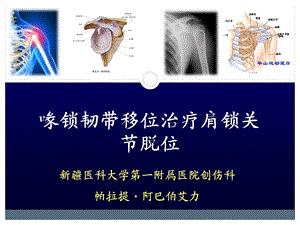 肩关节脱位 肌腱移位课件.ppt