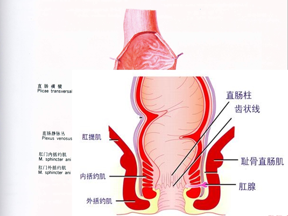 第03章第10 12节 直肠肛管疾病病人的护理课件.pptx_第3页