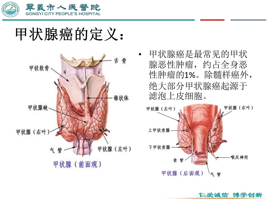 甲状腺癌教学查房 胸心外科课件.pptx_第2页