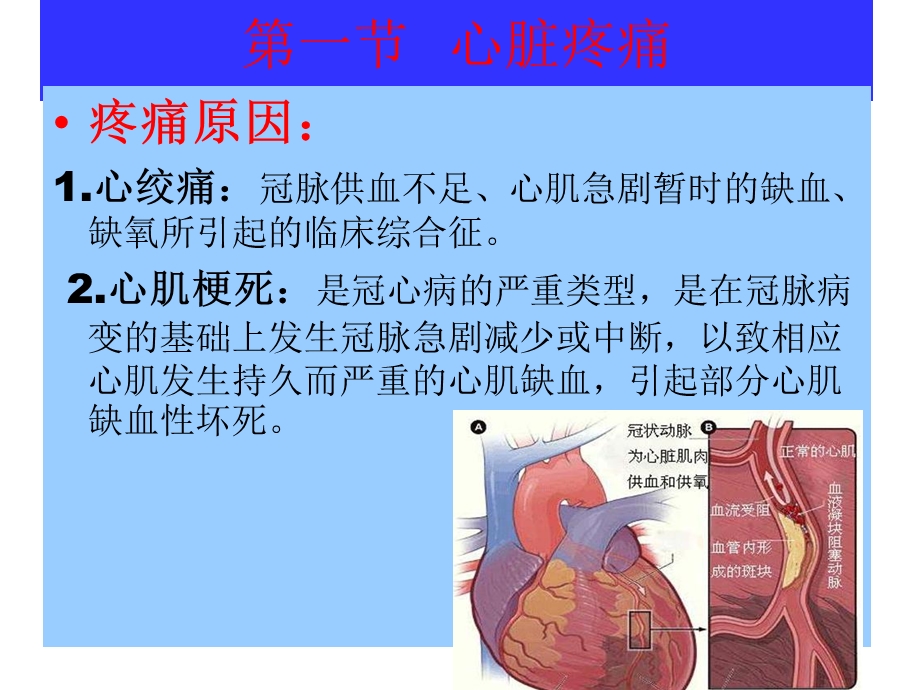 胸腹部疾病疼痛的护理课件.ppt_第3页