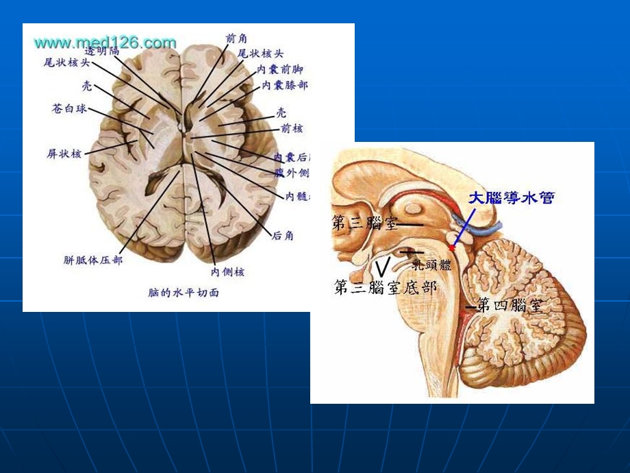 脑出血疾病查房课件.ppt_第3页