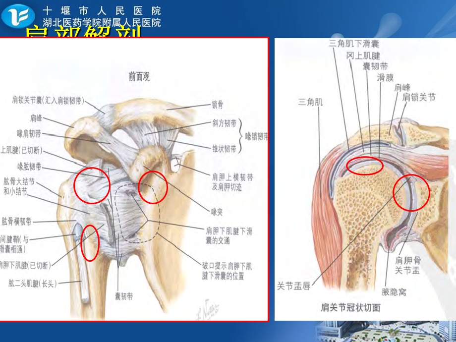 肩关节周围炎的治疗与护理课件.ppt_第3页